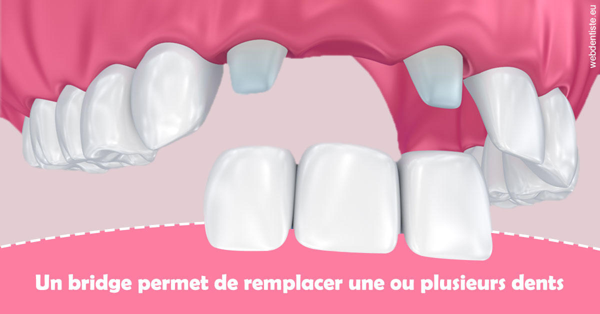https://dr-grandemenge-agnes.chirurgiens-dentistes.fr/Bridge remplacer dents 2