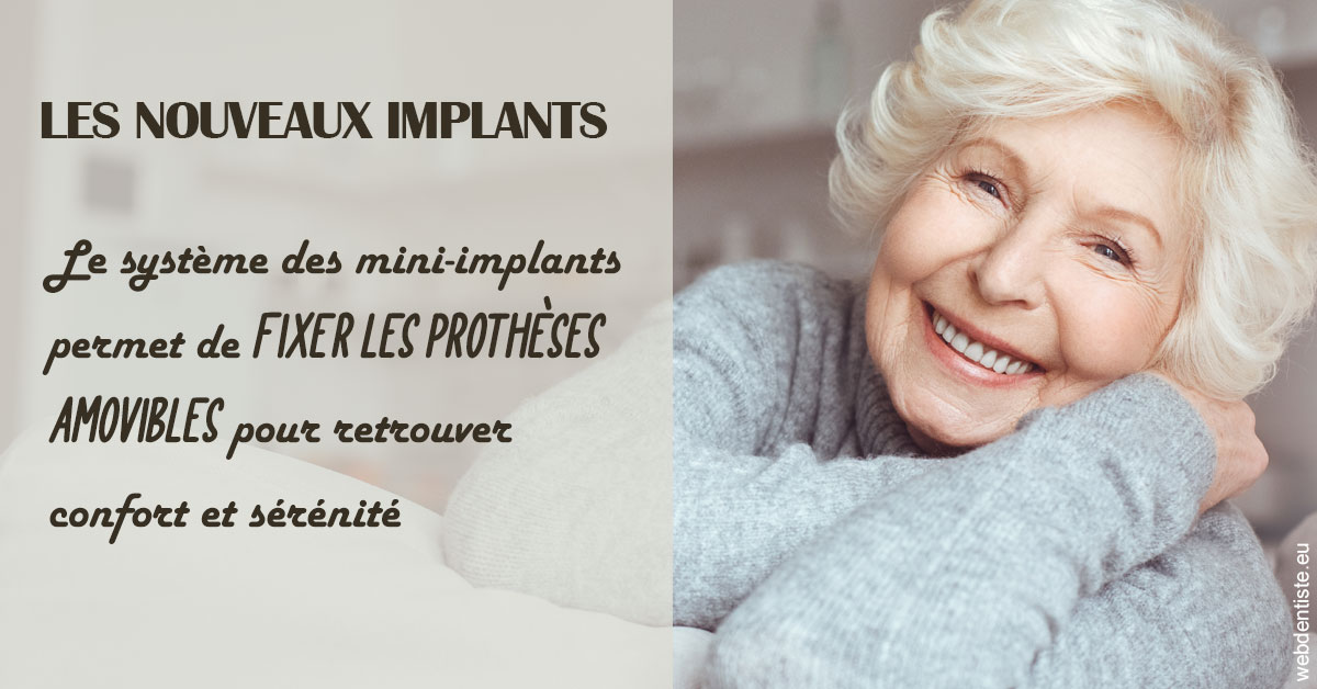 https://dr-grandemenge-agnes.chirurgiens-dentistes.fr/Les nouveaux implants 1