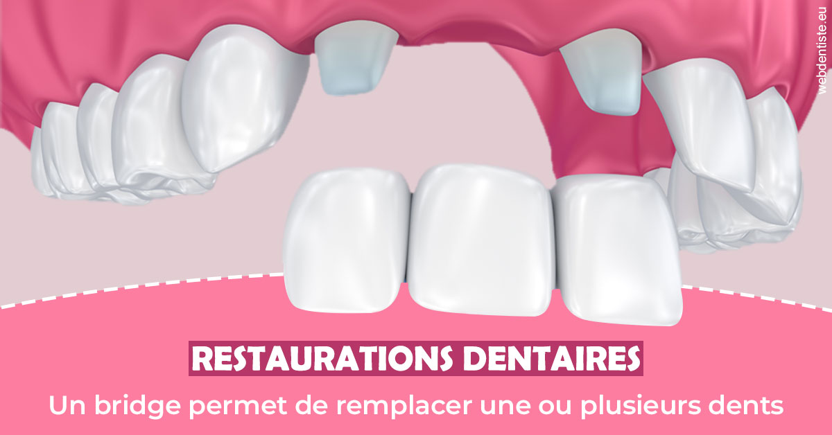 https://dr-grandemenge-agnes.chirurgiens-dentistes.fr/Bridge remplacer dents 2
