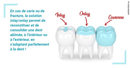 https://dr-grandemenge-agnes.chirurgiens-dentistes.fr/L'INLAY ou l'ONLAY