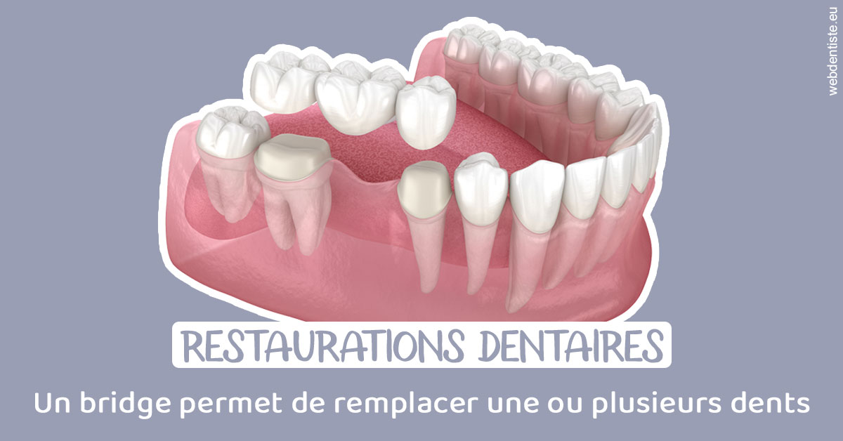 https://dr-grandemenge-agnes.chirurgiens-dentistes.fr/Bridge remplacer dents 1