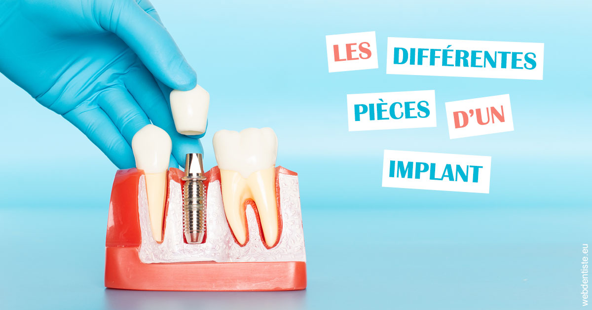 https://dr-grandemenge-agnes.chirurgiens-dentistes.fr/Les différentes pièces d’un implant 2