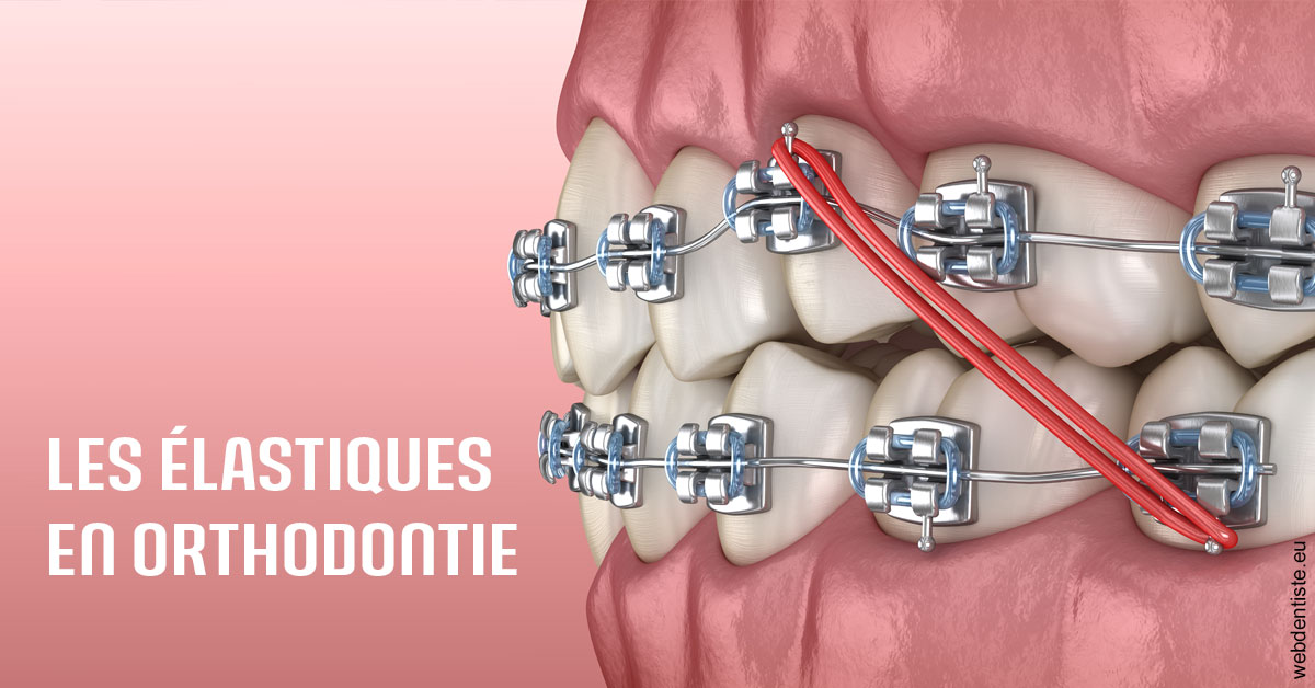 https://dr-grandemenge-agnes.chirurgiens-dentistes.fr/Elastiques orthodontie 2